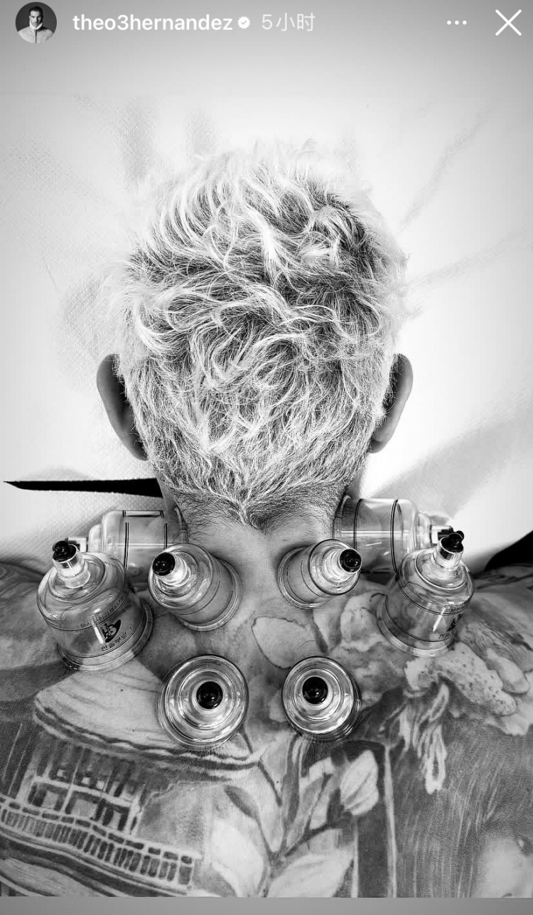 神秘東方力量加持?特奧社媒曬照,自己正在接受拔罐治療