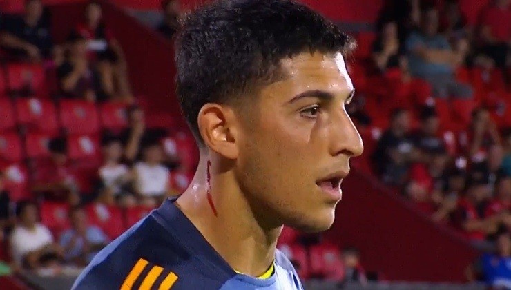 博卡門將被對方球迷丟下的玻璃劃傷脖子后流血，但他仍照常熱身